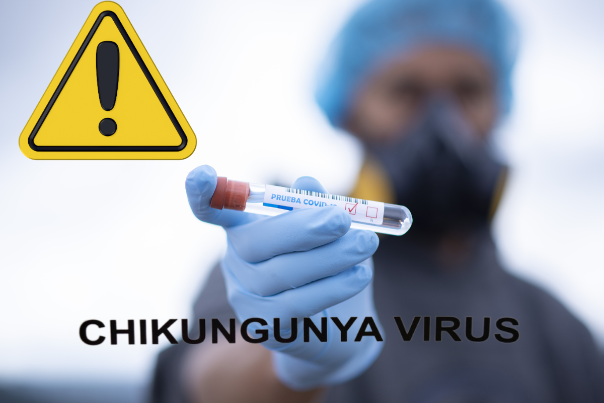 Virus chikungunya